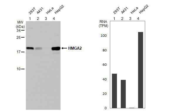 Western blot - Anti-HMGA2 antibody [HL1936] (AB308208), expandable thumbnail