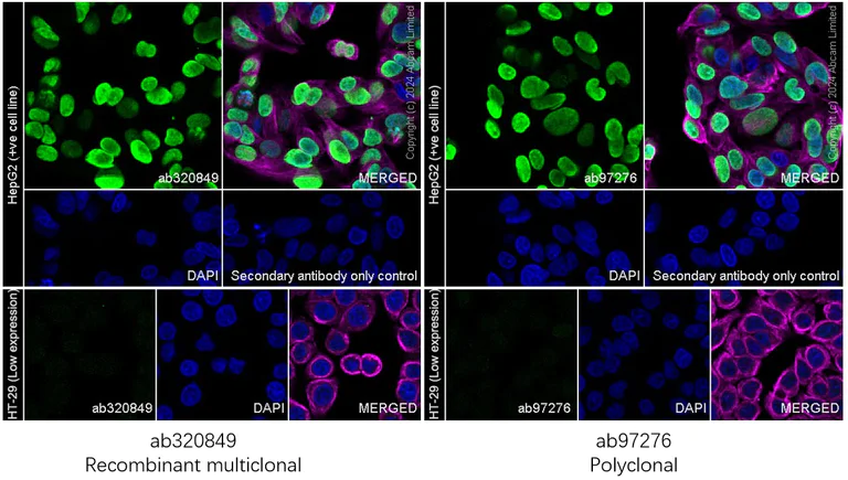 Immunocytochemistry/ Immunofluorescence - Anti-HMGA2 antibody [RM1215] - BSA and Azide free (AB320850)
