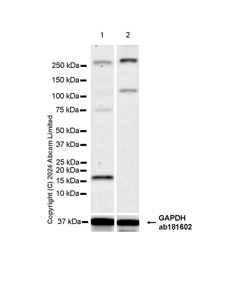 Western blot - Anti-HMGA2 antibody [RM1215] - BSA and Azide free (AB320850)