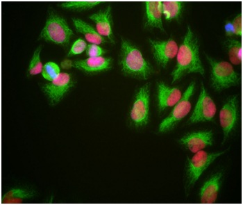Immunocytochemistry/ Immunofluorescence - Anti-HMGB1 antibody [1F3] (AB190377)