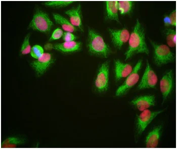 Immunocytochemistry/ Immunofluorescence - Anti-HMGB1 antibody [1F3] (AB190377)
