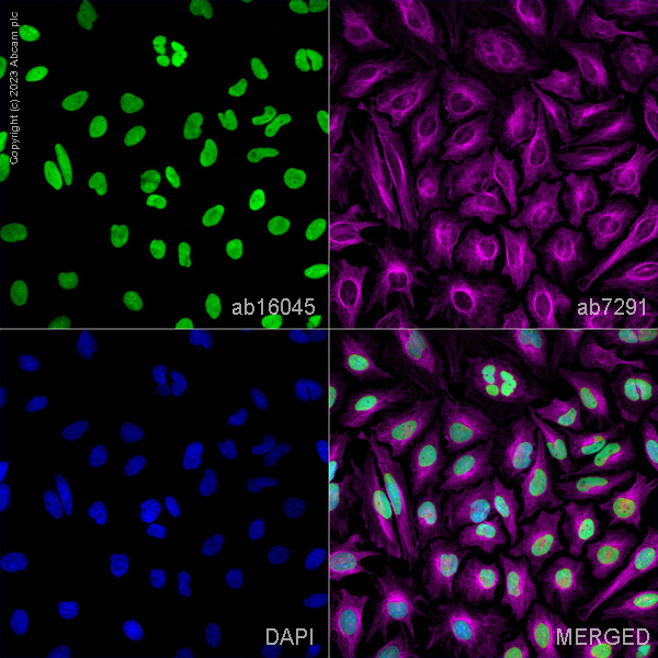 Immunocytochemistry/ Immunofluorescence - Anti-HMGB1 antibody (ab18256), expandable thumbnail