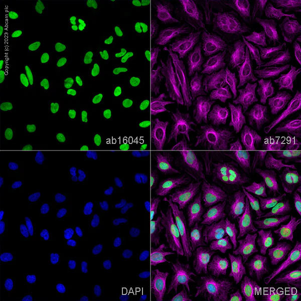 Immunocytochemistry/ Immunofluorescence - Anti-HMGB1 antibody (AB18256)