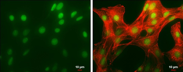 Immunocytochemistry/ Immunofluorescence - Anti-HMGB1 antibody (ab227168), expandable thumbnail