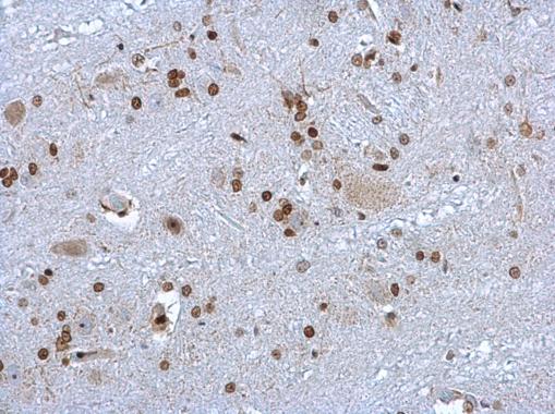 Immunohistochemistry (Formalin/PFA-fixed paraffin-embedded sections) - Anti-HMGB1 antibody (ab227168), expandable thumbnail