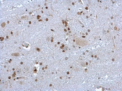 Immunohistochemistry (Formalin/PFA-fixed paraffin-embedded sections) - Anti-HMGB1 antibody (AB227168)