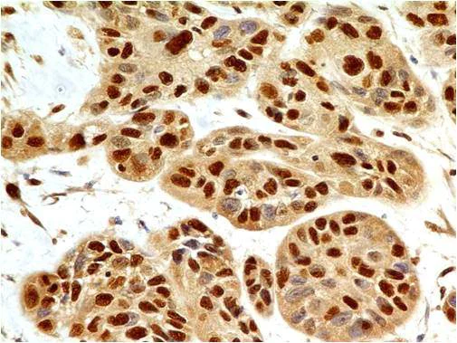 Immunohistochemistry (Formalin/PFA-fixed paraffin-embedded sections) - Anti-HMGB1 antibody [ABM24D3] (AB208282)