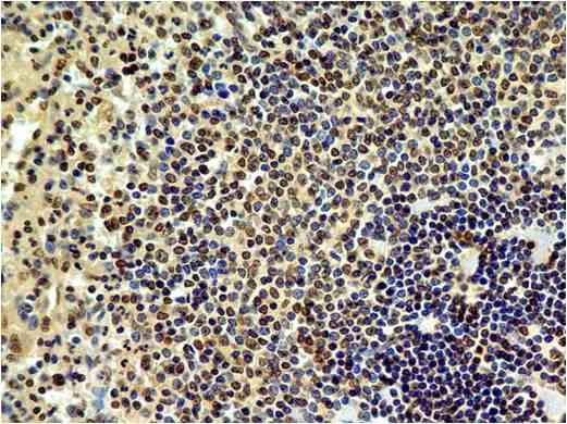 Immunohistochemistry (Formalin/PFA-fixed paraffin-embedded sections) - Anti-HMGB1 antibody [ABM24D3] (AB208282)