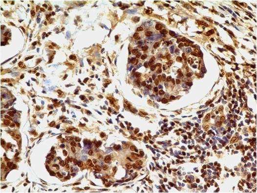 Immunohistochemistry (Formalin/PFA-fixed paraffin-embedded sections) - Anti-HMGB1 antibody [ABM24D3] (AB208282)