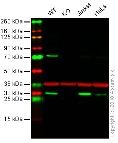 Western blot - Anti-HMGB1 antibody [EPR3506] (AB92310)
