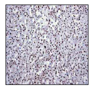 Immunohistochemistry (Formalin/PFA-fixed paraffin-embedded sections) - Anti-HMGB1 antibody [EPR3506] - BSA and Azide free (AB247536)