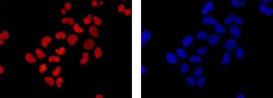 Immunocytochemistry/ Immunofluorescence - Anti-HMGB1 antibody [EPR3507] (ab79823), expandable thumbnail
