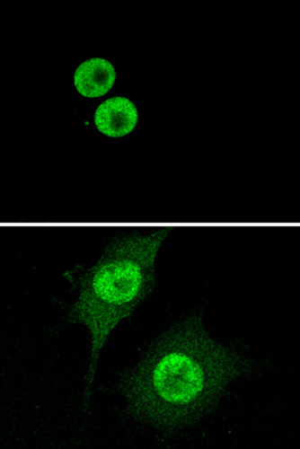 Immunocytochemistry/ Immunofluorescence - Anti-HMGB1 antibody [EPR3507] (AB79823), expandable thumbnail