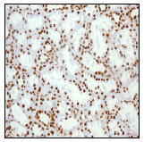 Immunohistochemistry (Formalin/PFA-fixed paraffin-embedded sections) - Anti-HMGB1 antibody [EPR3507] (ab79823), expandable thumbnail