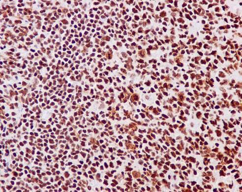 Immunohistochemistry (Formalin/PFA-fixed paraffin-embedded sections) - Anti-HMGB1 antibody [EPR3507] (ab79823), expandable thumbnail