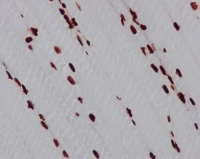 Immunohistochemistry (Formalin/PFA-fixed paraffin-embedded sections) - Anti-HMGB1 antibody [EPR3507] (AB79823)