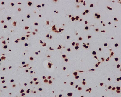 Immunohistochemistry (Formalin/PFA-fixed paraffin-embedded sections) - Anti-HMGB1 antibody [EPR3507] (AB79823)