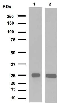 Western blot - Anti-HMGB1 antibody [EPR3507] (AB79823)