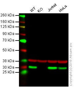 Western blot - Anti-HMGB1 antibody [EPR3507] (AB79823), expandable thumbnail