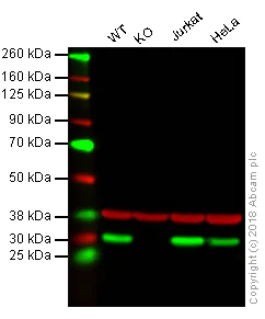 Western blot - Anti-HMGB1 antibody [EPR3507] (AB79823)