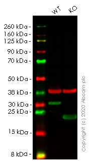 Western blot - Anti-HMGB1 antibody [EPR3507] (AB79823), expandable thumbnail