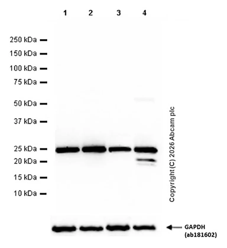 Western blot - Anti-HMGB1 antibody [EPR3507] (AB79823)