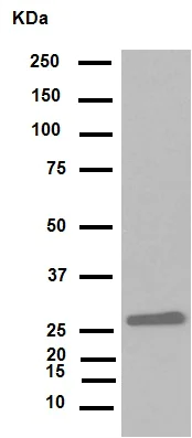 Western blot - Anti-HMGB1 antibody [EPR3507] (AB79823)