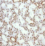 Immunohistochemistry (Formalin/PFA-fixed paraffin-embedded sections) - Anti-HMGB1 antibody [EPR3507] - BSA and Azide free (AB216986)