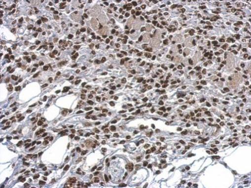 Immunohistochemistry (Formalin/PFA-fixed paraffin-embedded sections) - Anti-HMGB1 antibody - N-terminal (ab228624), expandable thumbnail