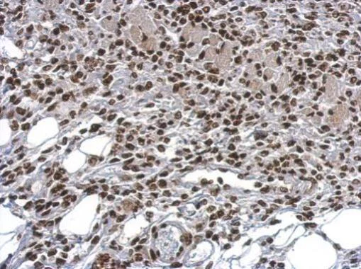 Immunohistochemistry (Formalin/PFA-fixed paraffin-embedded sections) - Anti-HMGB1 antibody - N-terminal (AB228624)