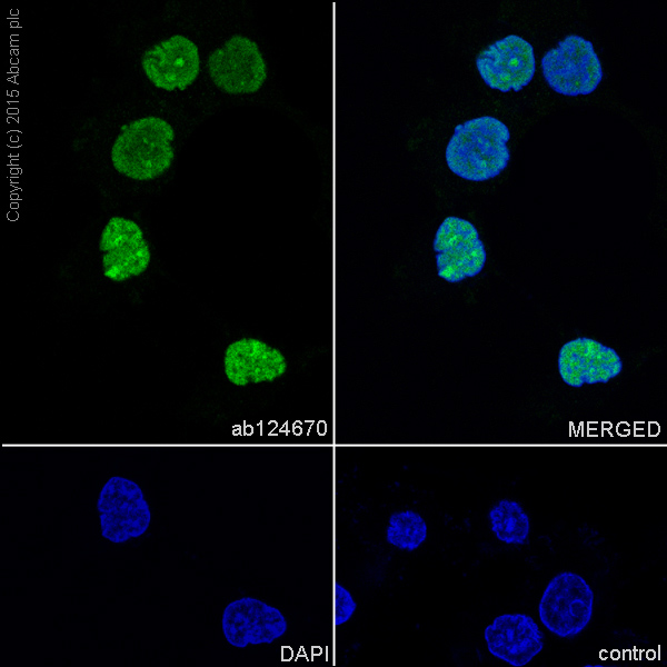 Immunocytochemistry/ Immunofluorescence - Anti-HMGB2 antibody [EPR6301] (AB124670), expandable thumbnail