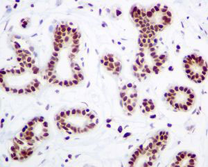 Immunohistochemistry (Formalin/PFA-fixed paraffin-embedded sections) - Anti-HMGB2 antibody [EPR6301] (AB124670), expandable thumbnail