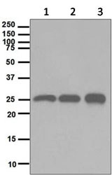 Western blot - Anti-HMGB2 antibody [EPR6301] (AB124670), expandable thumbnail