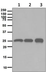 Western blot - Anti-HMGB2 antibody [EPR6301] (AB124670)