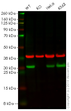 Western blot - Anti-HMGB2 antibody [EPR6301] (AB124670), expandable thumbnail