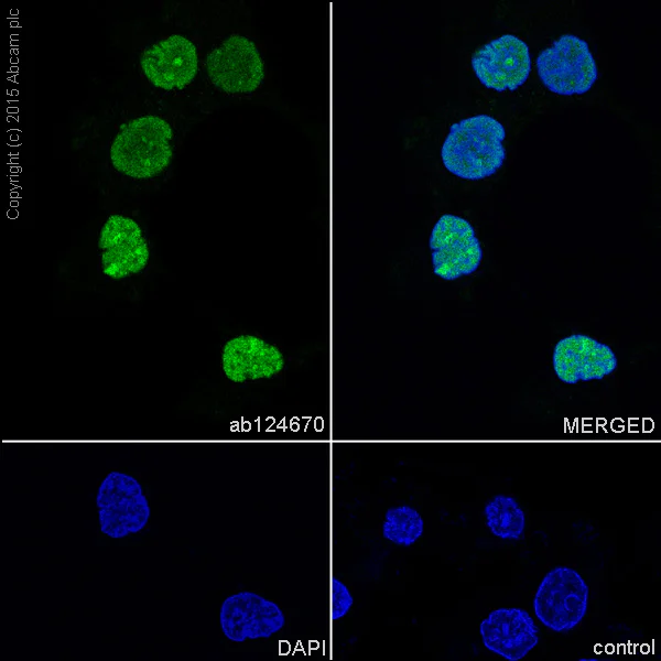 Immunocytochemistry/ Immunofluorescence - Anti-HMGB2 antibody [EPR6301] - BSA and Azide free (AB239992)
