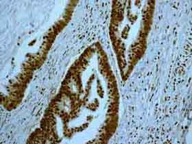 Immunohistochemistry (Formalin/PFA-fixed paraffin-embedded sections) - Anti-HMGB2 antibody [EPR6302] (AB133540), expandable thumbnail