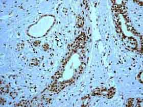 Immunohistochemistry (Formalin/PFA-fixed paraffin-embedded sections) - Anti-HMGB2 antibody [EPR6302] (AB133540), expandable thumbnail