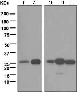 Western blot - Anti-HMGB2 antibody [EPR6302] (AB133540), expandable thumbnail