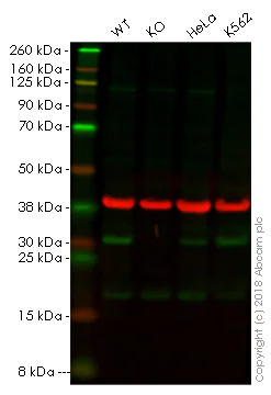 Western blot - Anti-HMGB2 antibody [EPR6302] (AB133540)