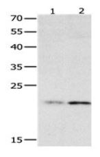 Western blot - Anti-HMGB4 antibody (AB182655), expandable thumbnail