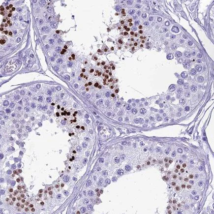 Immunohistochemistry (Formalin/PFA-fixed paraffin-embedded sections) - Anti-HMGB4 antibody (AB224500)