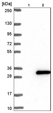 Western blot - Anti-HMGB4 antibody (AB224500)