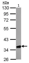 Western blot - Anti-HMGCL antibody (AB97293)