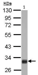 Western blot - Anti-HMGCL antibody (AB97293)