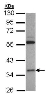 Western blot - Anti-HMGCL antibody (AB97293)