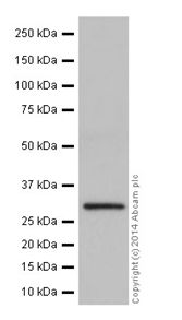 Western blot - Anti-HMGCL antibody [EPR15551] (AB197022), expandable thumbnail