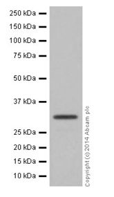 Western blot - Anti-HMGCL antibody [EPR15551] (AB197022), expandable thumbnail