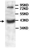 Western blot - Anti-HMGCLL1 antibody (AB101576)