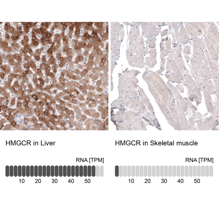 Immunohistochemistry (Formalin/PFA-fixed paraffin-embedded sections) - Anti-HMGCR Antibody [CL0259] (AB327101)